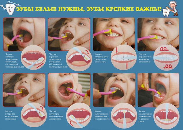 Как ухаживать за зубами ребенка